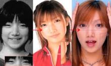 $美容外科医ジョニー のブログ
